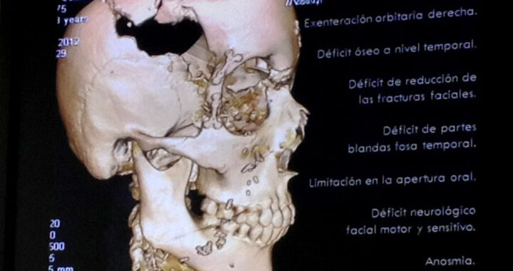 Maria de Villota tras el accidente
